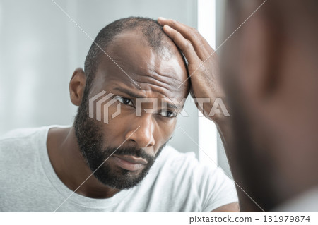 Worried man examining thinning hair in mirror 131979874