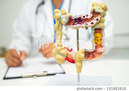 Intestine, appendix and digestive system, doctor holding anatomy model for study diagnosis and treatment in hospital. Intestine, appendix and digestive system, doctor holding anatomy model for study diagnosis and treatment in hospital. 131981610