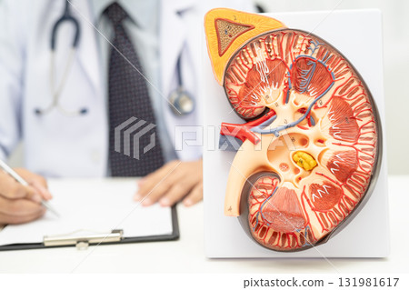 Kidney disease, Chronic kidney disease ckd, Doctor hold human model to treat and study in hospital. 131981617