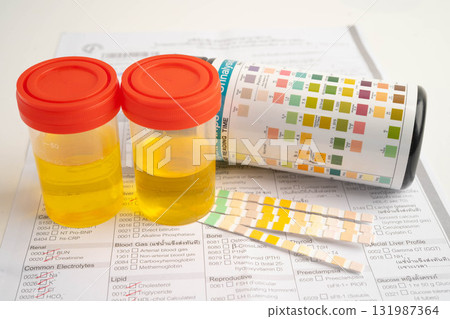 Urinalysis, urine cup with reagent strip pH paper test and comparison chart in laboratory. Urinalysis, urine cup with reagent strip pH paper test and comparison chart in laboratory. 131987364