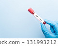 Blood sample tube with PSA test on medical laboratory technologist hands over blue background. A blood test that measures the level of prostate specific antigen to screen for prostate cancer. 131993212