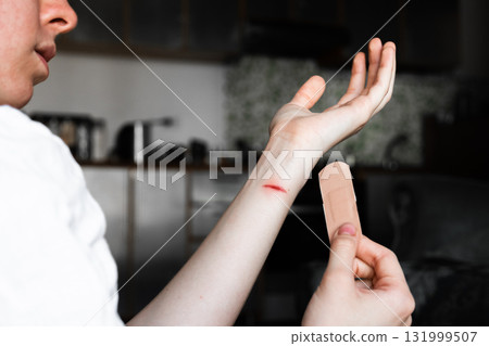 A person applies a medical plaster to a burn on their forearm. The skin is light with a visible red mark from the burn. The plaster is beige and held in one hand. A person applies a medical plaster to a burn on their forearm. The skin is light with a visible red mark from the burn. The plaster is beige and held in one hand. 131999507