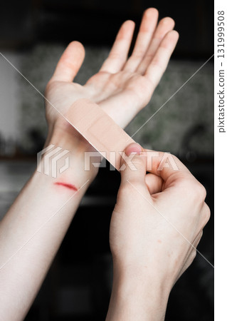 A person applies a medical plaster to a burn on their forearm. The skin is light with a visible red mark from the burn. The plaster is beige and held in one hand. A person applies a medical plaster to a burn on their forearm. The skin is light with a visible red mark from the burn. The plaster is beige and held in one hand. 131999508