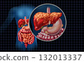 Fatty Liver Disease 132013337