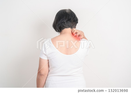 Elderly woman itching Neck and body scratching for Skin Allergy from insect bite and food dermatitis. Dermatology, Leprosy day, Systemic lupus erythematosus, Psoriasis, Urticaria and rash Eczema 132013698