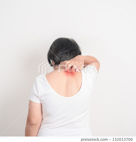 Elderly woman itching Neck and body scratching for Skin Allergy from insect bite and food dermatitis. Dermatology, Leprosy day, Systemic lupus erythematosus, Psoriasis, Urticaria and rash Eczema 132013700