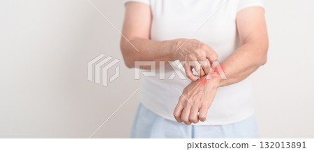 Elderly woman itching arm and body scratching for Skin Allergy from insect bite and food dermatitis. Dermatology, Leprosy day, Systemic lupus erythematosus, Psoriasis, Urticaria and rash Eczema Elderly woman itching arm and body scratching for Skin Allergy from insect bite and food dermatitis. Dermatology, Leprosy day, Systemic lupus erythematosus, Psoriasis, Urticaria and rash Eczema 132013891