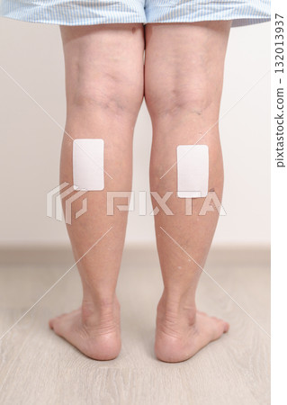 Elderly woman having Calf pain with Medicated pain relief patch plaster for concepts of Calf Muscle Strain, muscle pull, Leg Cramp, Sprain, aches, Varicose Veins, Deep Vein and world Thrombosis day 132013937