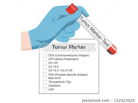 Tumor marker is a substance used to help detect diagnose and monitor the treatment or recurrence of cancer in the body. 132023020