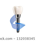 Dental implant with blue arrow. Realistic 3D render on white background for medical and professional use. 132038345