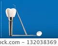 Dental implant poster with tools. 3D medical illustration and infographic on blue background for professional and educational use. 132038369