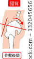 駝背、骨盆後傾 132045656