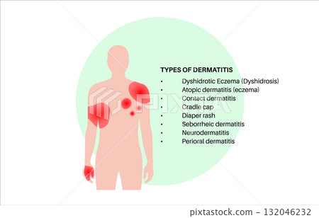 Dermatitis skin disease 132046232