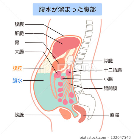 Abdomen with ascites 132047543