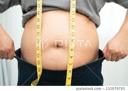 Asian woman with fat belly big size overweight and obesity with measure tape. 132079785