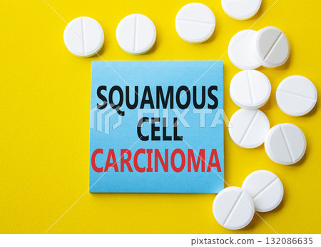 Squamous Cell Carcinoma symbol. Concept words Squamous Cell Carcinoma on blue note. Beautiful yellow background with pills. Healthcare and Squamous Cell Carcinoma concept. Copy space. 132086635