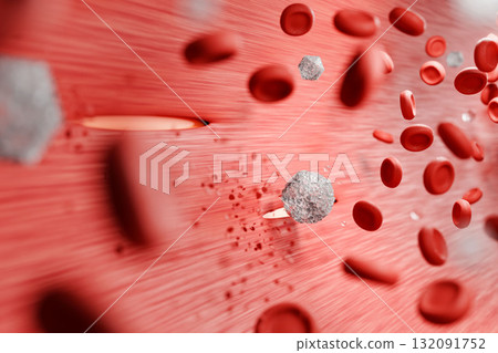 高血糖損傷血管引起的糖尿病併發症 3D醫學插圖 132091752