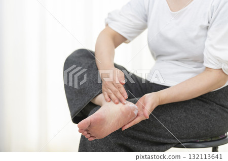 Senior woman applying cream to dry heels 132113641