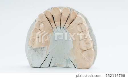 Sectioned dental cast of upper teeth arch 132116766