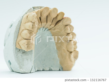 Angled view of upper dental arch cast 132116767