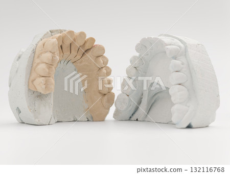 Paired upper dental arch casts for restoration Paired upper dental arch casts for restoration 132116768
