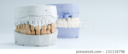 Dental plaster model for prosthetic teeth fitting 132116796
