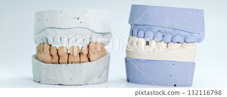 Side-by-side dental cast models for oral restoration 132116798
