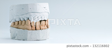 Dental stone model for crown fitting procedure 132116802