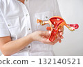 Close-up anatomical model of the female uterus with images of cancerous growths and tumors, polyps. 132140521