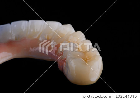 Full dental zirconium prosthesis on titanium bar stained with stains for ceramic. 132144389