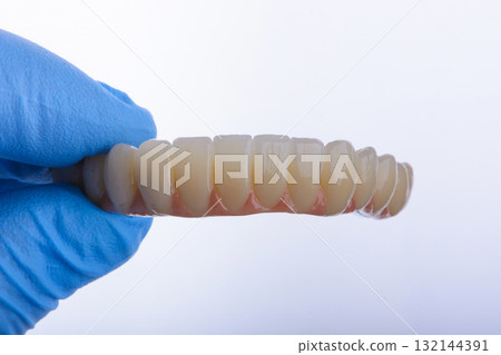 Full dental zirconium prosthesis on titanium bar stained with stains for ceramic. Full dental zirconium prosthesis on titanium bar stained with stains for ceramic. 132144391