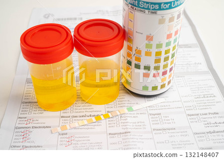 Urinalysis, urine cup with reagent strip pH paper test and comparison chart in laboratory. 132148407