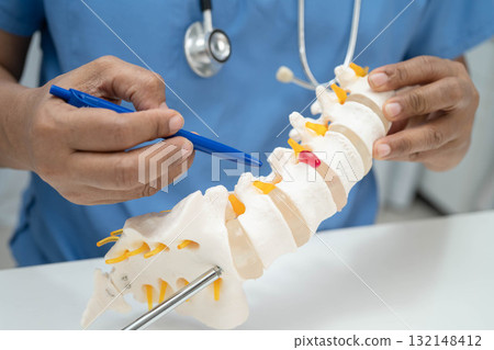 Asian doctor holding spinal nerve and bone model, Lumbar spine displaced herniated disc fragment for treatment medical in the orthopedic department. 132148412