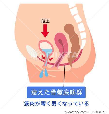 骨盆底肌肉無力 骨盆底肌肉 132168148