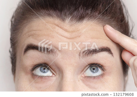 Caucasian woman shows her facial wrinkles on her forehead. Folds on the skin. Close up 132179608