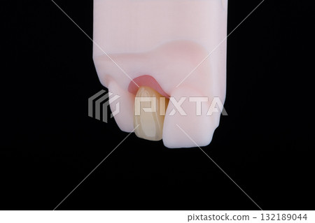 Mirror copy of lateral maxillary incisor, zirconia crown on titanium abutment fixed on printed model Mirror copy of lateral maxillary incisor, zirconia crown on titanium abutment fixed on printed model 132189044
