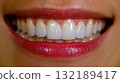 A close up of a woman's smile with white teeth 132189417