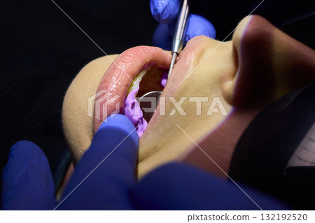 Highlighting the Importance of Orthodontic Impressions in Dental Procedures and Care Highlighting the Importance of Orthodontic Impressions in Dental Procedures and Care 132192520