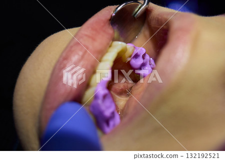 Highlighting the Importance of Orthodontic Impressions in Dental Procedures and Care 132192521