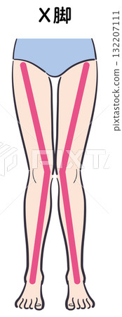 Illustration of X-legs (with auxiliary lines) 132207111