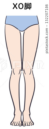 XO腿圖 132207186