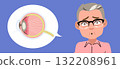Cartoon Illustration Of Senior Man With Cataracts On Blue Background 132208961