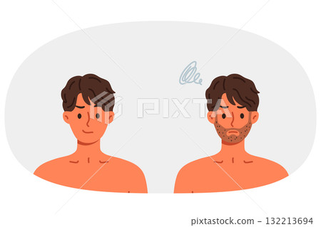 Unshaven man was transformed and become handsome after using new razor with sharp blade 132213694