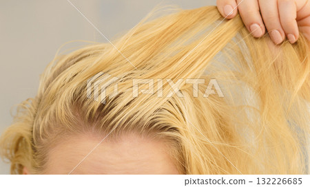 Blonde woman having greasy hair 132226685
