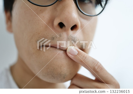 一名男子經過五次鬍鬚去除療程後,嘴巴和下巴周圍仍殘留著斑駁的鬍鬚。 一名男子經過五次鬍鬚去除療程後,嘴巴和下巴周圍仍殘留著斑駁的鬍鬚。 132236015