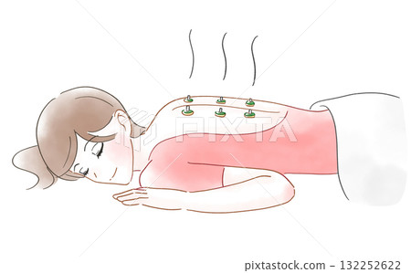 一位女士背部艾灸的水彩畫 一位女士背部艾灸的水彩畫 132252622