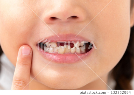 小學生女孩的乳牙 132252994