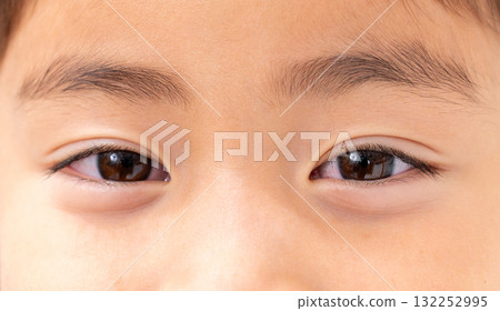 小學生眼睛 132252995