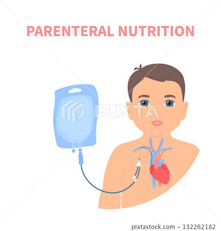 Child receiving parenteral nutrition through a central intravenous access 132262182