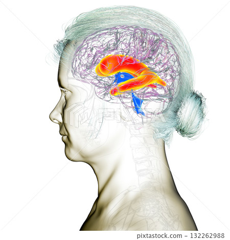Enlarged lateral ventricles of the brain, 3D illustration Enlarged lateral ventricles of the brain, 3D illustration 132262988